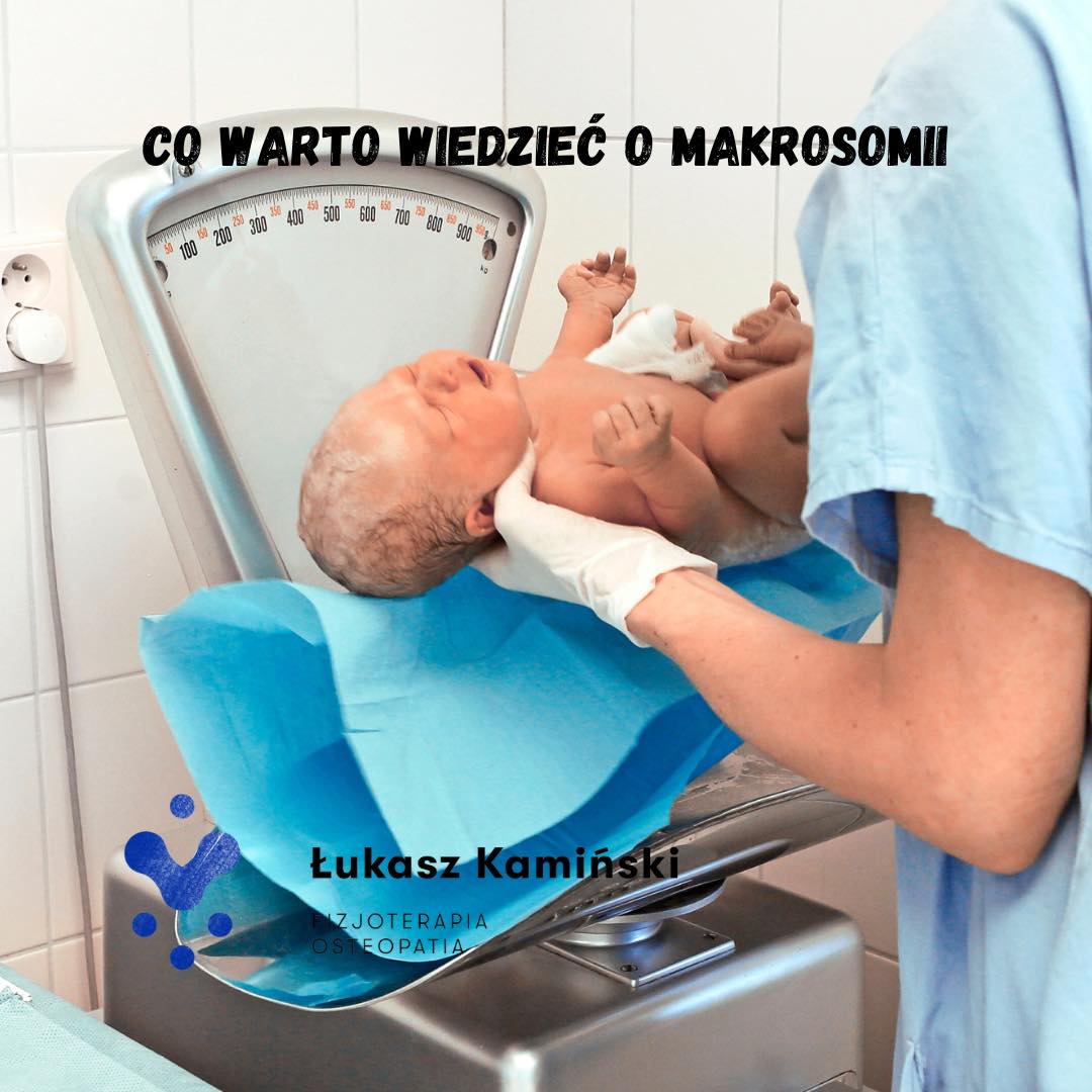 Makrosomia