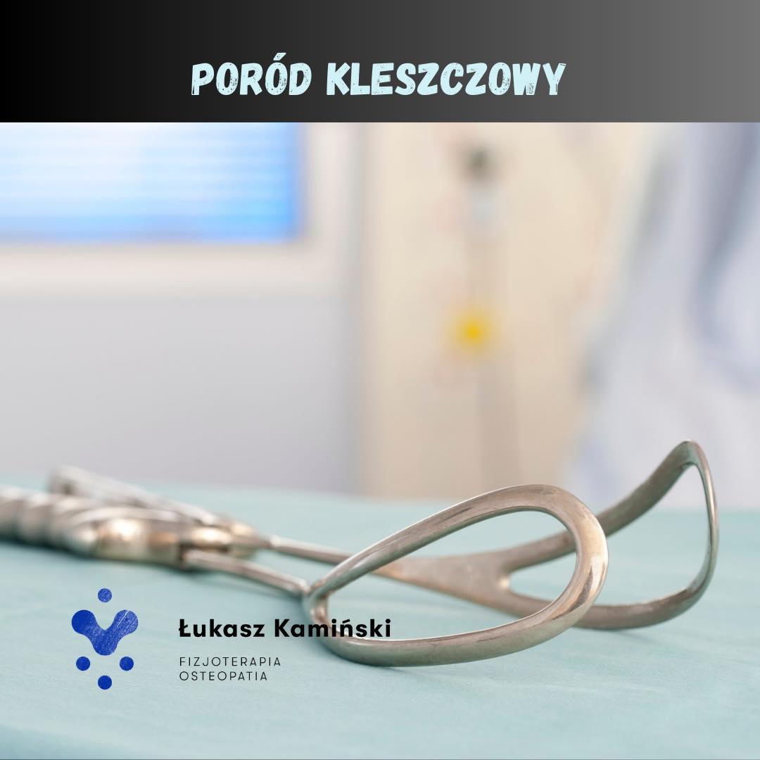 Poród kleszczowy 