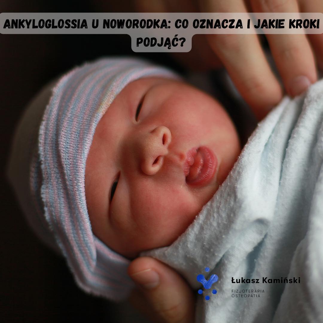 Ankyloglossia